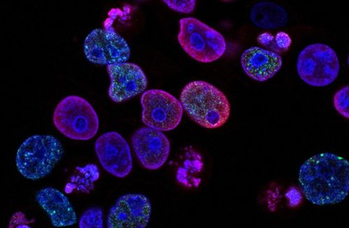 瑞士生物科技公司invasight利用突破性的細(xì)胞間蛋白靶點發(fā)現(xiàn)平臺,開發(fā)蛋白質(zhì) 蛋白質(zhì)相互作用抑制劑,靶向治療侵襲性癌癥 瑞士創(chuàng)新100強